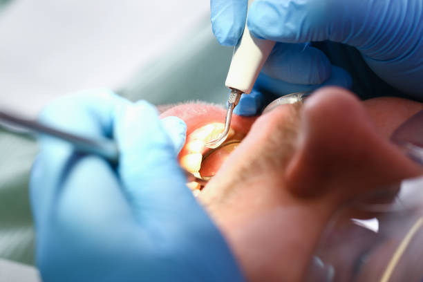 Best Pediatric Emergency Dentist in St Lawrence, PA