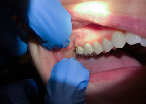 Best Emergency Dental Services for Seniors in St Lawrence, PA